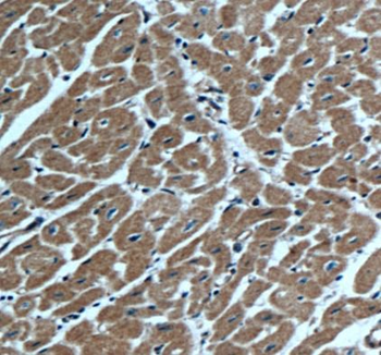 ACTN1 Rabbit Polyclonal Antibody