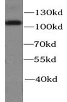 CTNNA1 Rabbit Polyclonal Antibody