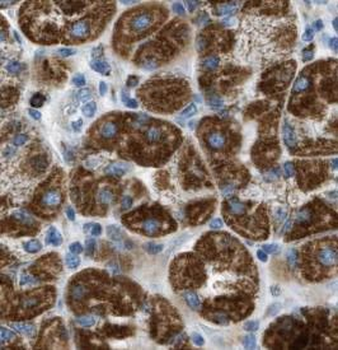 CTNNA1 Rabbit Polyclonal Antibody