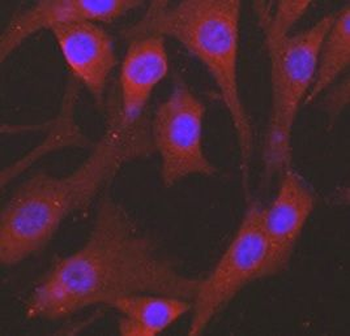 alpha Tubulin Mouse Monoclonal Antibody