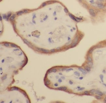 ALPG Rabbit Polyclonal Antibody