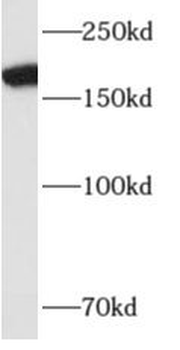 ALS2 Rabbit Polyclonal Antibody