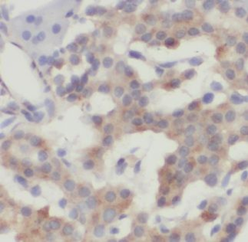 ALS2 Rabbit Polyclonal Antibody