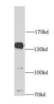 AMBRA1 Rabbit Polyclonal Antibody