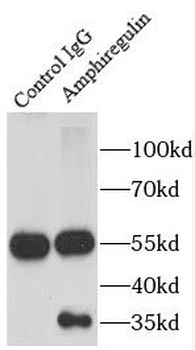 AREG Rabbit Polyclonal Antibody