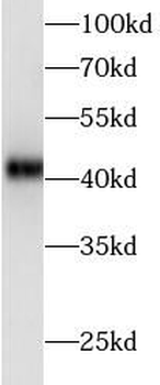 AREG Rabbit Polyclonal Antibody