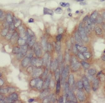 AREG Rabbit Polyclonal Antibody