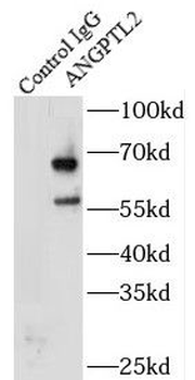ANGPTL2 Rabbit Polyclonal Antibody