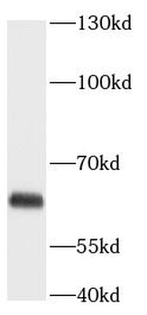 ANGPTL2 Rabbit Polyclonal Antibody