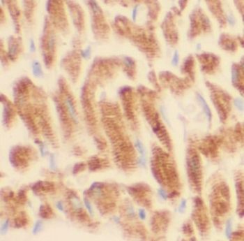 ANGPTL2 Rabbit Polyclonal Antibody