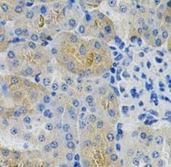 ANGPTL3 Rabbit Polyclonal Antibody