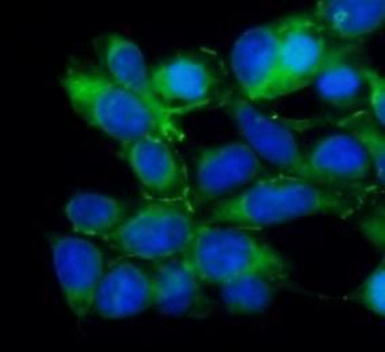ANGPTL4 Rabbit Polyclonal Antibody