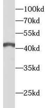 ANGPTL4 Rabbit Polyclonal Antibody