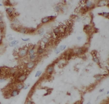 ANGPTL4 Rabbit Polyclonal Antibody
