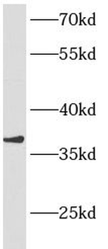 ANKRD1 Rabbit Polyclonal Antibody