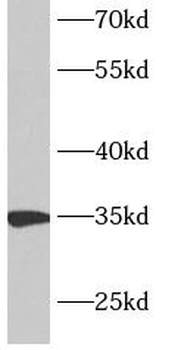 ANKRD54 Rabbit Polyclonal Antibody