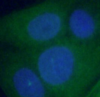 ANXA1 Rabbit Polyclonal Antibody