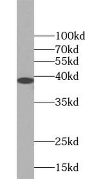 ANXA1 Rabbit Polyclonal Antibody