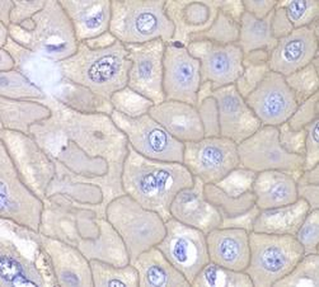 ANXA1 Rabbit Polyclonal Antibody