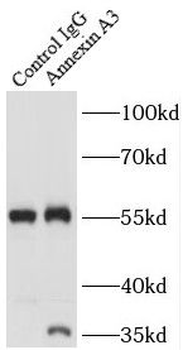 ANXA3 Rabbit Polyclonal Antibody