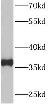 ANXA3 Rabbit Polyclonal Antibody
