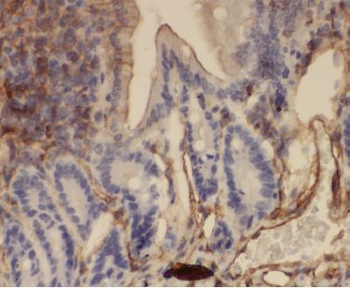 ANXA3 Rabbit Polyclonal Antibody