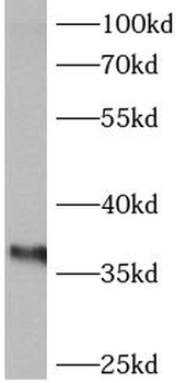 ANXA4 Rabbit Polyclonal Antibody
