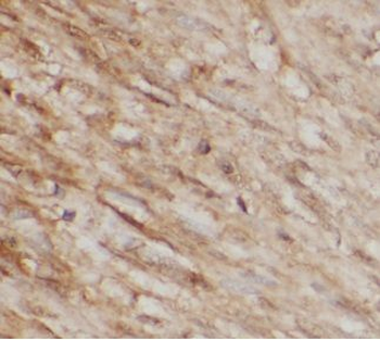 ANXA4 Rabbit Polyclonal Antibody