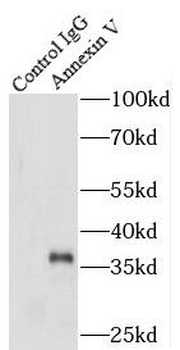 ANXA5 Rabbit Polyclonal Antibody