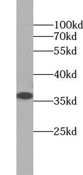 ANXA5 Rabbit Polyclonal Antibody
