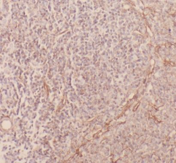 ANXA5 Rabbit Polyclonal Antibody