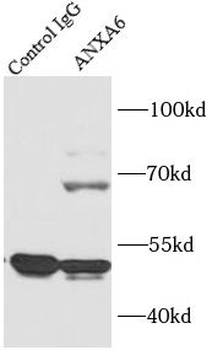 ANXA6 Rabbit Polyclonal Antibody