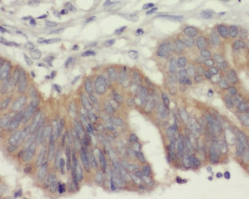 ANXA6 Rabbit Polyclonal Antibody