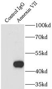 ANXA7 Rabbit Polyclonal Antibody