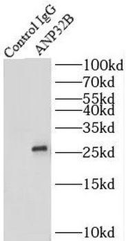 ANP32B Rabbit Polyclonal Antibody