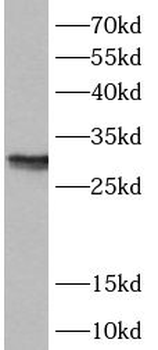 ANP32B Rabbit Polyclonal Antibody
