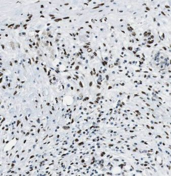 ANP32B Rabbit Polyclonal Antibody