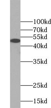 AP1M1 Rabbit Polyclonal Antibody