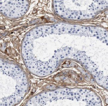AP2A2 Rabbit Polyclonal Antibody
