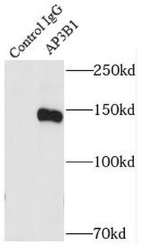 AP3B1 Rabbit Polyclonal Antibody