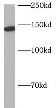 AP3B1 Rabbit Polyclonal Antibody