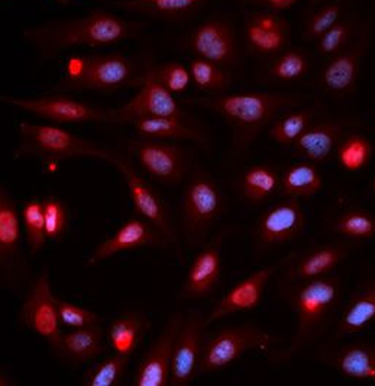 APEX1 Rabbit Polyclonal Antibody