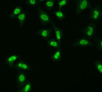 APEX1 Rabbit Polyclonal Antibody