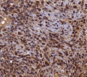 APEX1 Rabbit Polyclonal Antibody