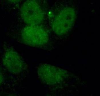 API5 Rabbit Polyclonal Antibody