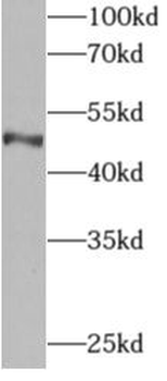 API5 Rabbit Polyclonal Antibody