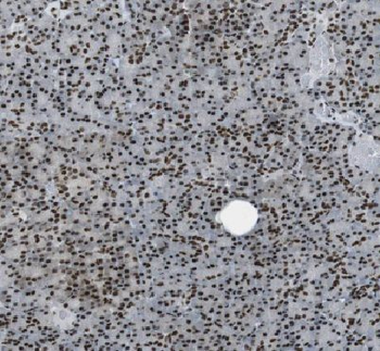 API5 Rabbit Polyclonal Antibody