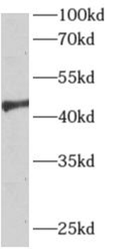 APLNR Rabbit Polyclonal Antibody