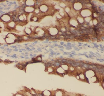 APLNR Rabbit Polyclonal Antibody