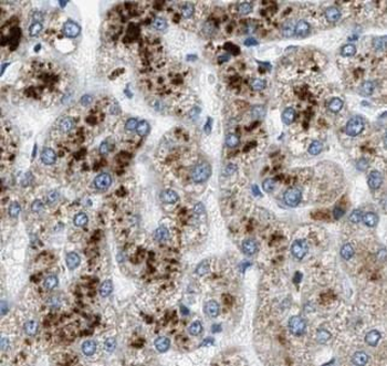 APOB Rabbit Polyclonal Antibody